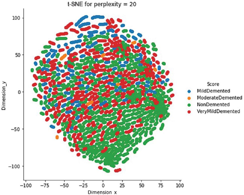 t-SNE visualization of the Alzheimer dataset